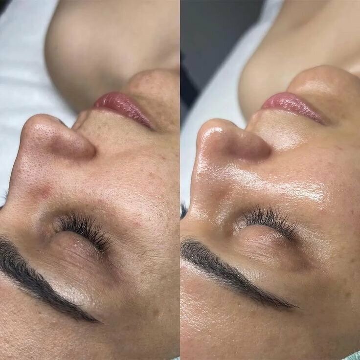 Cosmetology Кабинет эстетической косметологии Анастасии Соловьевой, Pochep, photo