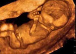 Fetal Memories 2d 3D 4D Ultrasound (United States, Orange, 1018 N Tustin St), medical laboratory