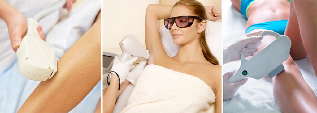 laser hair removal - Laser hair removal Aft - Krasnogorsk, photo 7.