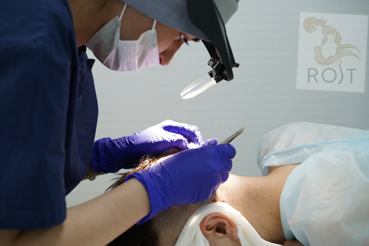 как проходит трансплантация волос