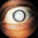 Lazer Optik (Tekirdağ, Corlu District, Salih Omurtak Cad., 178), opticial store