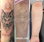 Sokolov Laser (Rabochaya Street, 33) ، مركز طبي، عيادة