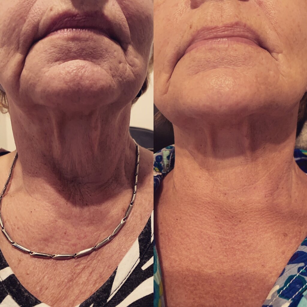 Spa Wymore Laser & Anti-Aging Medicine in Winter Park, Fl, Orlando, photo