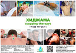 Hijama sunna stavropol (Pirogova Street, 15/1), alternative medicine