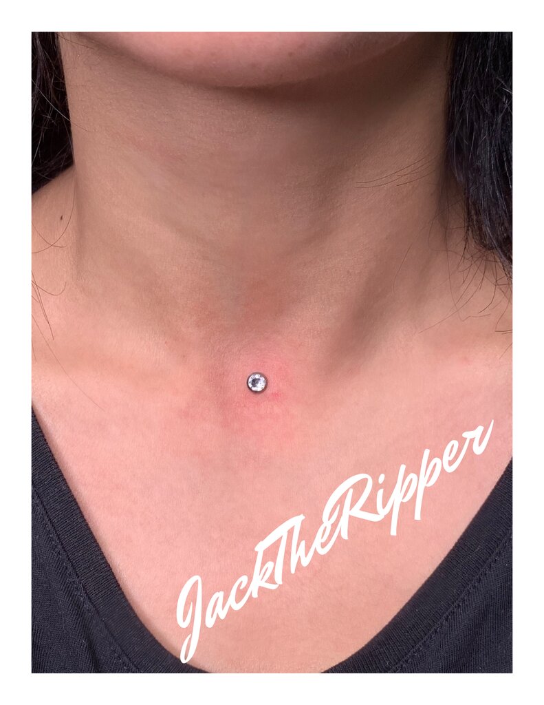 Микродермал как крепится схема