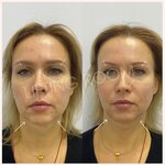 Lifting Room (Bolshoy Sukharevsky Lane, 23с2), beauty salon