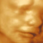 ABC Bebe 3D 4D Ultrasounds (Bogotá, Chapinero, Carrera 11, 96-47), family planning clinic