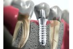 Portal Implantatsiya zubov (Saksahanskoho Street, 22А) ، مكاتب وسائل الإعلام الجماهيرية