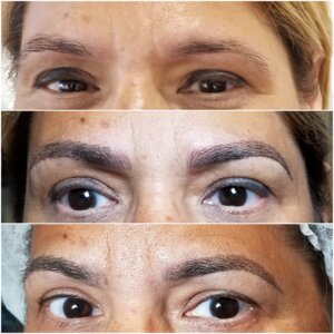 Revive Aesthetics Oc (United States, Lake Forest, 25411 Trabuco Road, 222) ، منتجعات