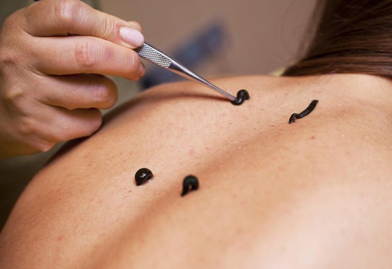 Фото Малые Соли