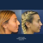 New York Plastic Surgical Group (United States, Brooklyn, 330 9th St), plastic surgery