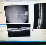 Studio Oculistico Dott. Zito Michele (Apulia, Bari, Via Santi Cirillo e Metodio, 5), optical instruments and equipment