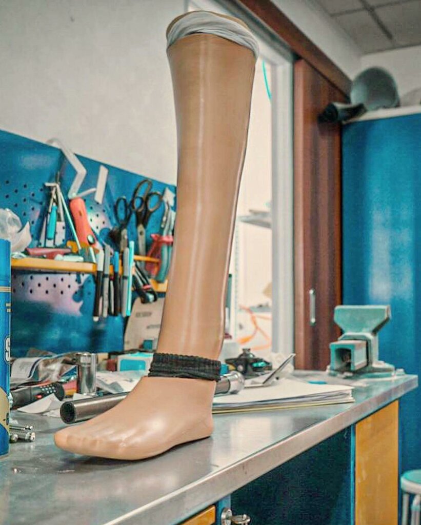 Изготовление протезно-ортопедических изделий Орто-Инновации Севастополь, Севастополь, фото