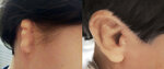 Microtia Clinic in Israel (Ben Zvi Yitzhak, 7), medical center, clinic