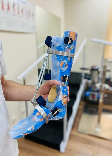 Изготовление протезно-ортопедических изделий Орто-Инновации Крым, Симферополь, фото