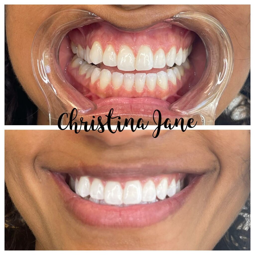 صالون تجميل Christina Jane Teeth Whitening and Beauty Bar ، كولومبوس، صورة