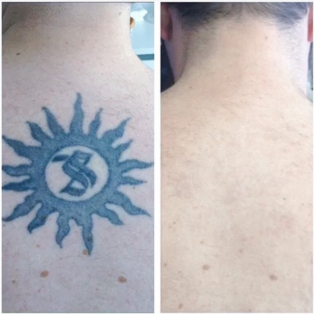 Cosmetology Clean Skin Laser, Moscow, photo