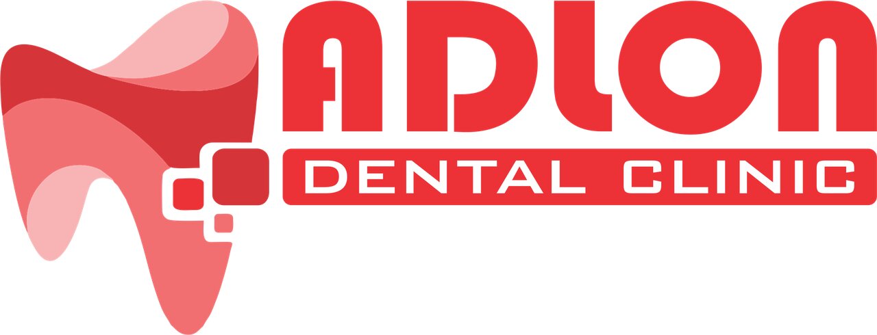 Adlon
