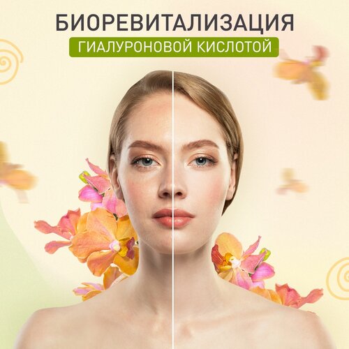 Все фото