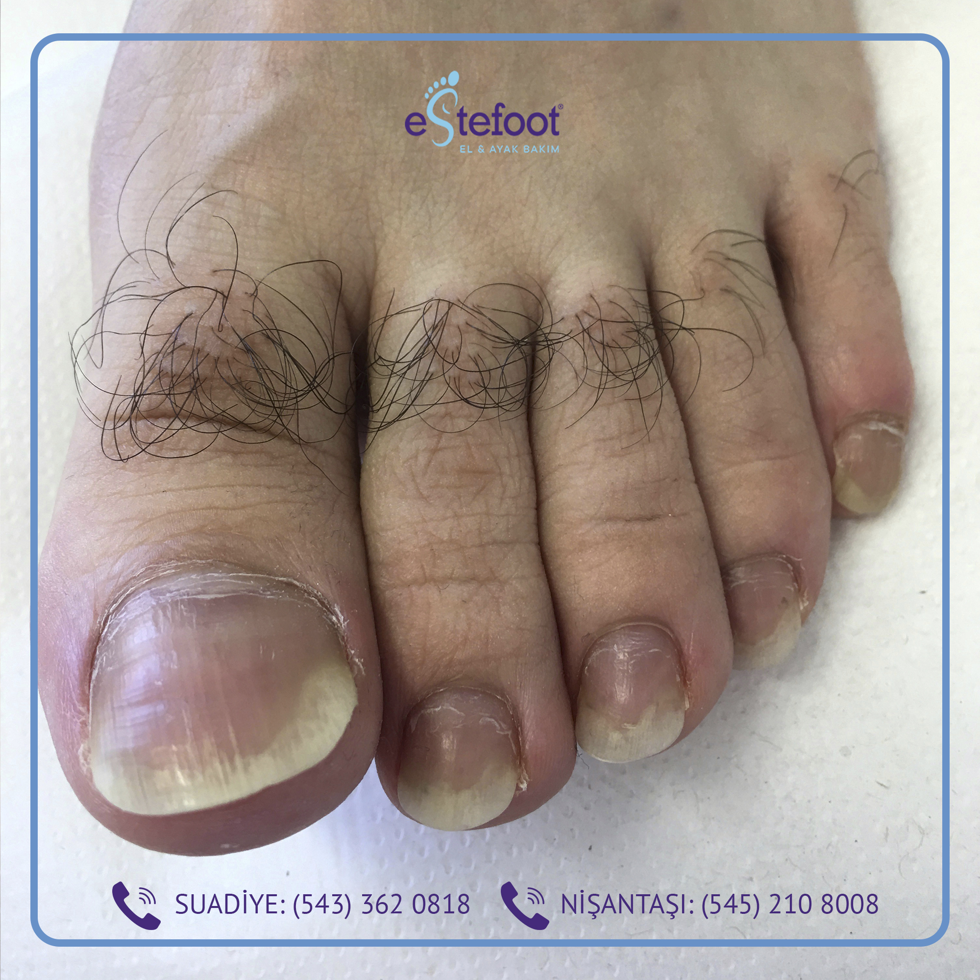 Estefoot Suadiye Ayak ve El Bakımı