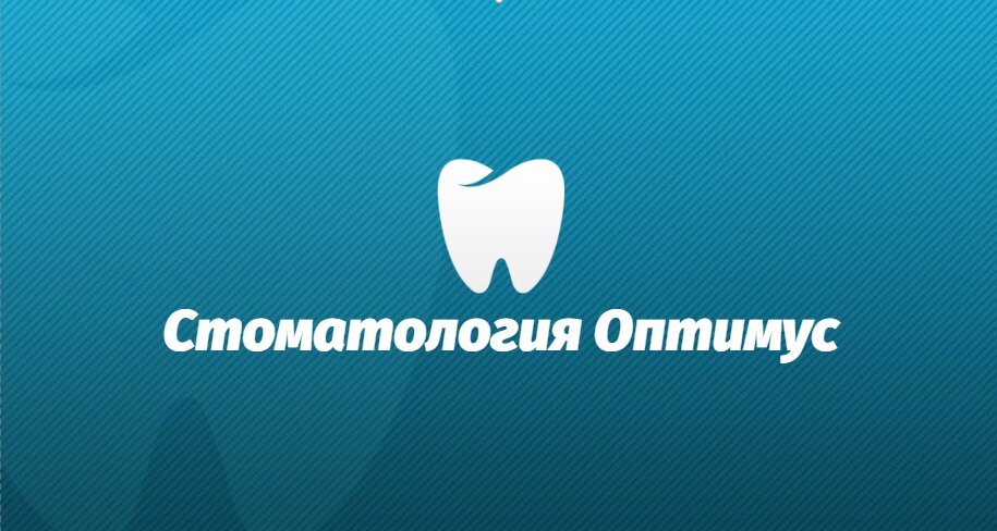 Оптимус