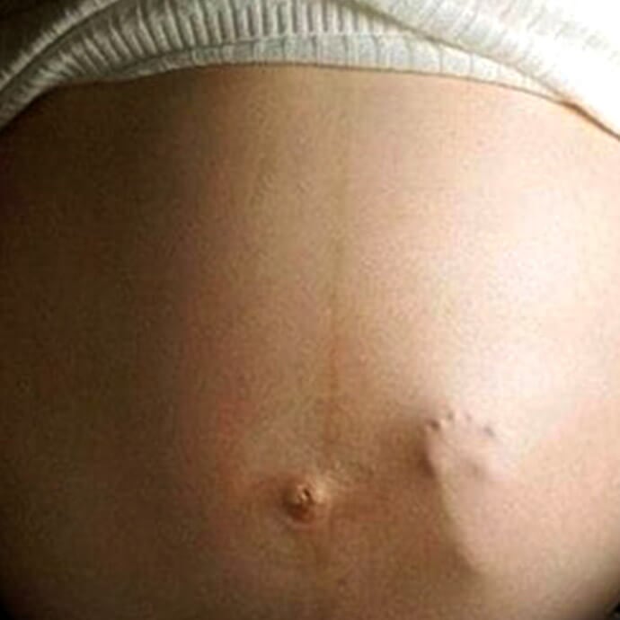 Первые толчки жизни: когда начинается шевеление ребенка при беременности и о чем оно говорит