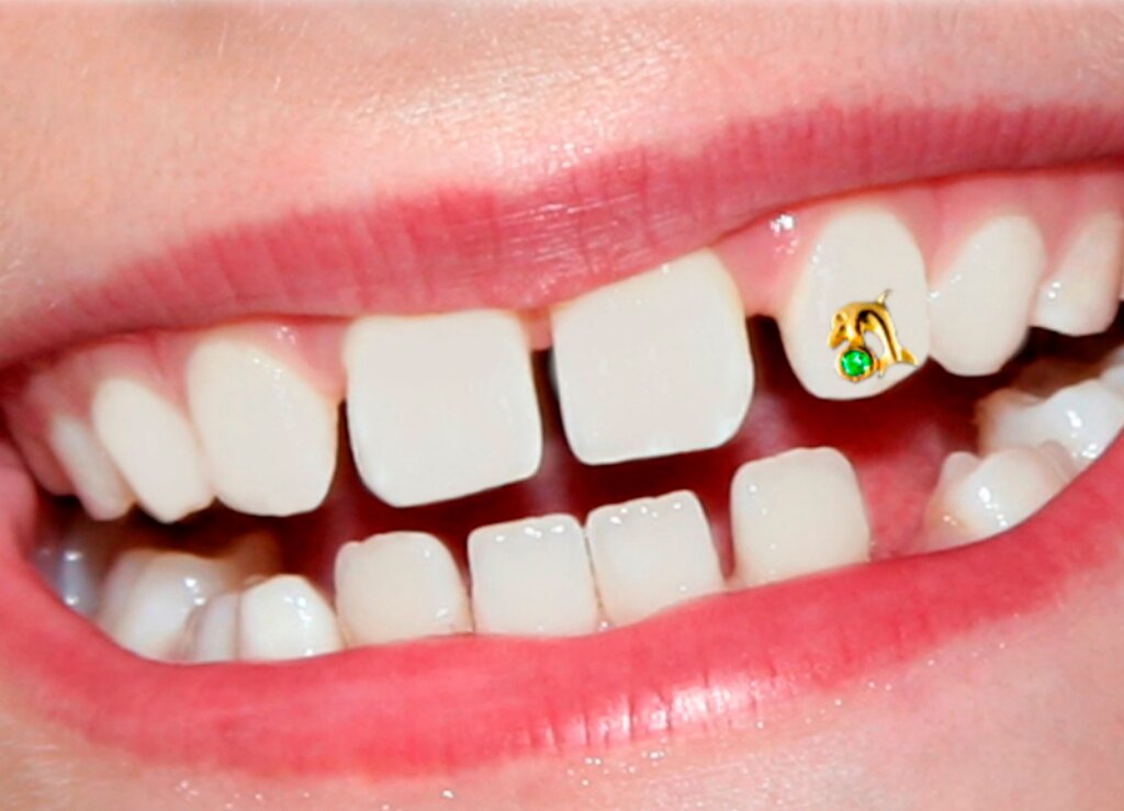 Страз в зубах картинки