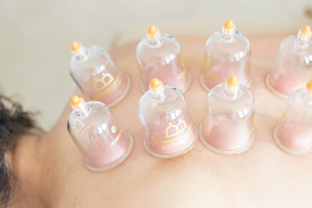 Muslim Hijama Ru