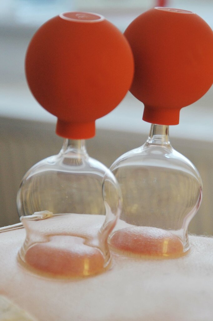 Muslim Hijama Ru