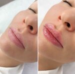 CosmoEpiL (1st Spasonalivkovsky Lane, 19), cosmetology