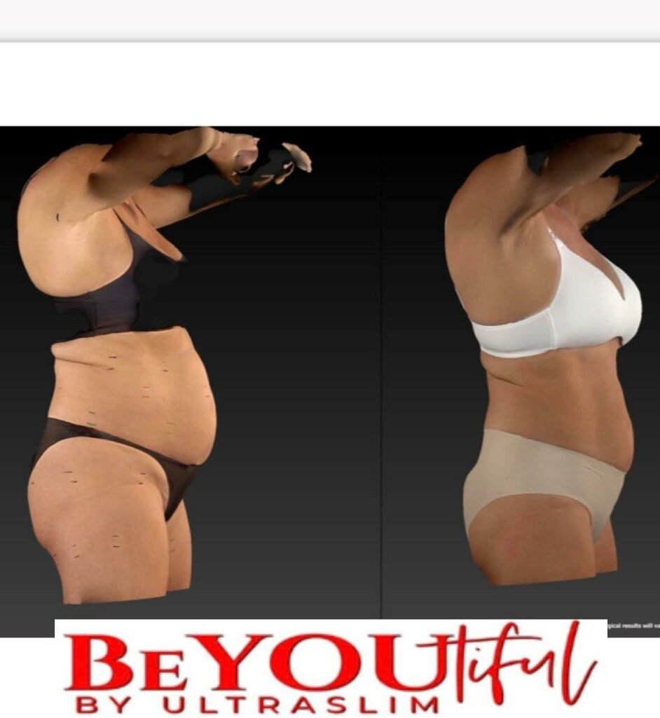 Spa BeYOUtiful by UltraSlim, Lubbock, photo
