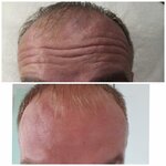 Тэффи (Dneprovskiy pereulok, 5/1), cosmetology