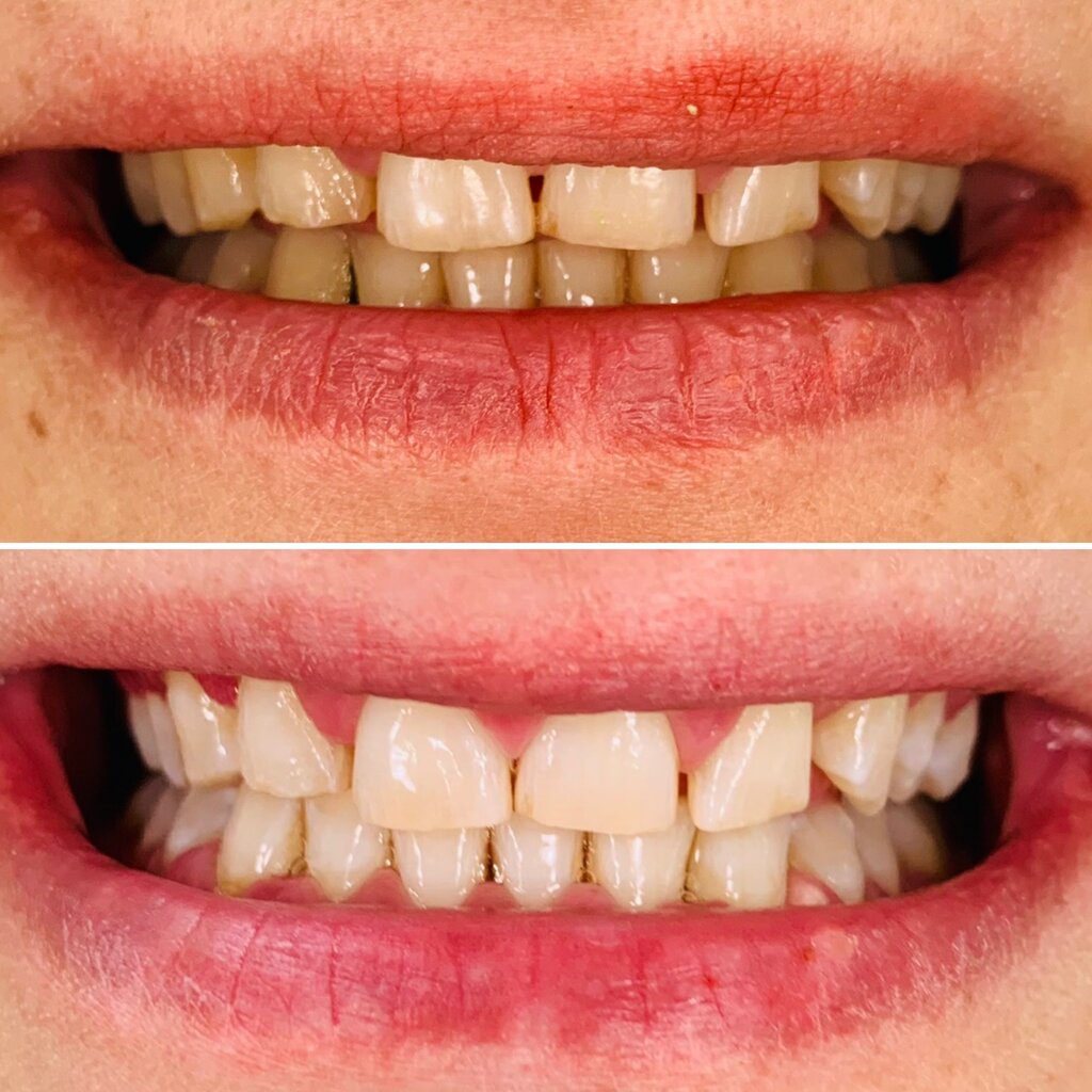 Dental clinic Q Klinik - Dis Hekimi Guliz Karacaoglu, Guzelbahce, photo