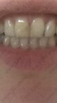 Professorskaya klinika Zheleznykh (ulitsa Serebryanyye Klyuchi, 6), dental clinic