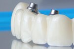 Pb Dentallab (Egorova Street, 23БВ) ، مختبر أسنان