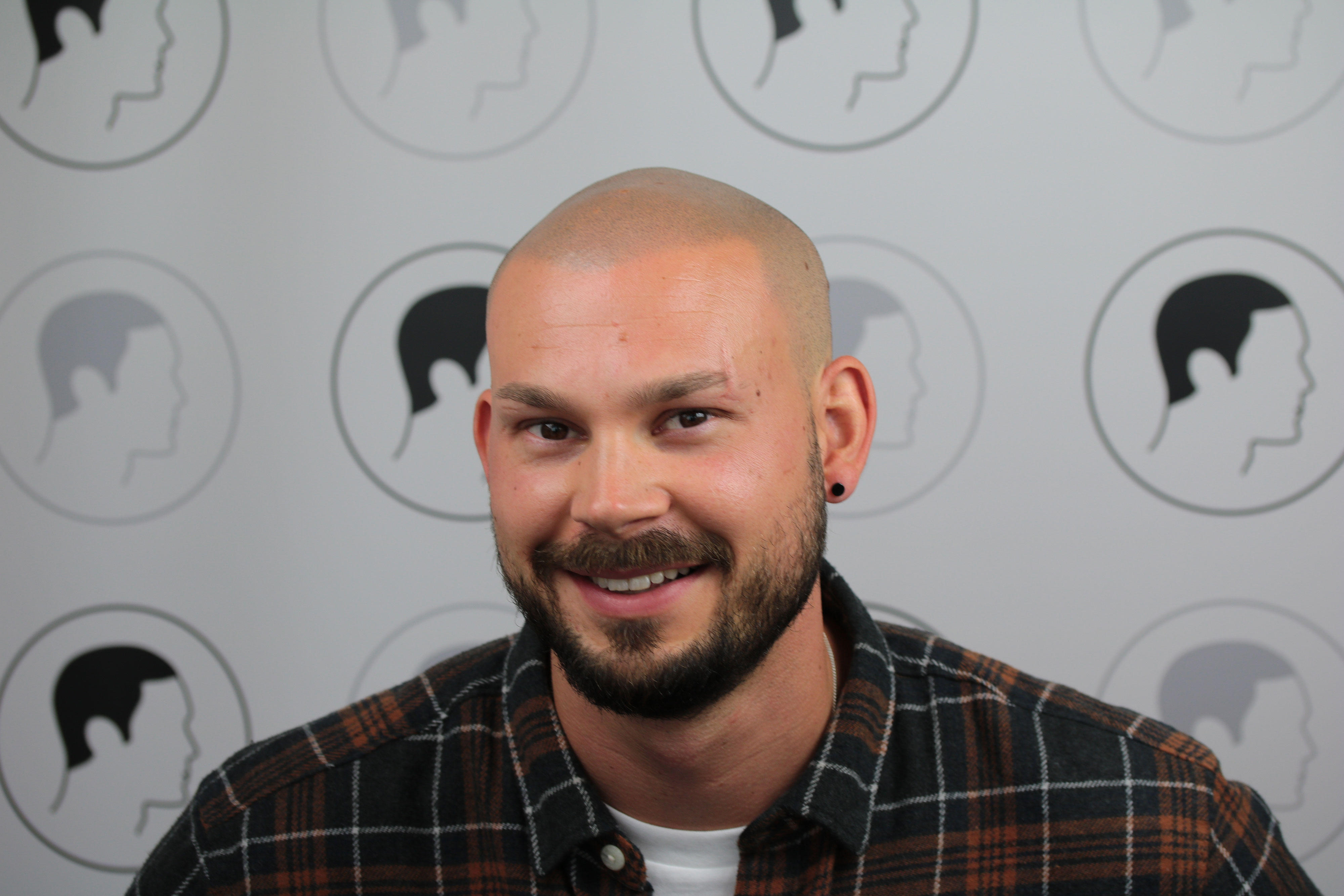 Haarpigmentierung Modern Hair Loss Solution