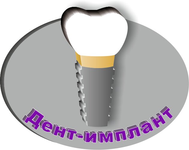 Дент-имплант