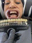 Exclusive Micro Scalp & Teeth Whitening (Rhode Island, Kent County, West Warwick), tattoo studio