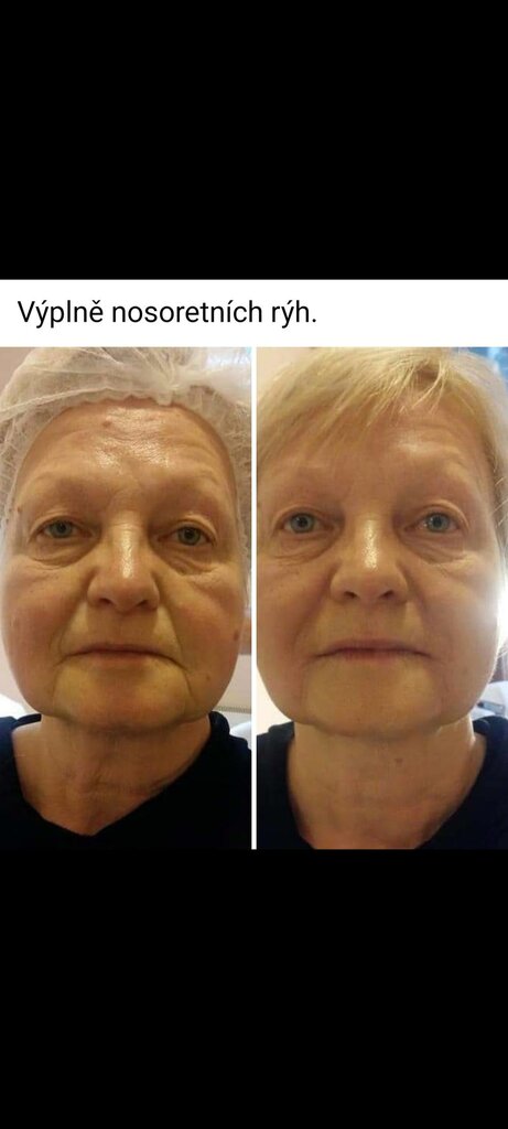 Beauty salon Kosmetický salon V kadeřnictví u Kačky, Karlovy Vary Region, photo