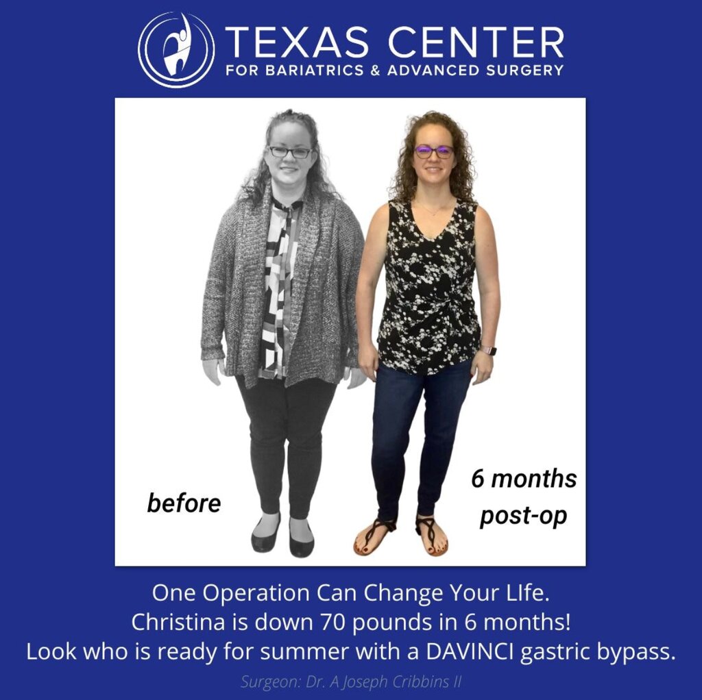 Dietetic and diabetic nutrition Texas Center for Bariatrics & Advanced Surgery, Plano, photo