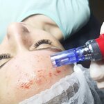 Anastasiya Mur (Zheleznodorozhny Microdistrict, ulitsa Kornilayeva, 16), cosmetología