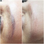 Arctic Laser (Olega Koshevogo Street, 6к2) ، علم التجميل
