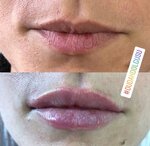 Dr. Ali Kilic (Istanbul, Atasehir, Ataturk Neighborhood, Ertugrul Gazi Street, 2E) ، أطباء بعيادات خاصة