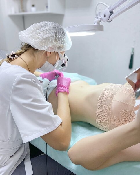 Hair removal Electroepilation Studio Olga Strizhko, Simferopol, photo