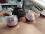 Konya Center Cupping Therapy (Konya, Selçuklu, Ahmet Hilmi Nalçacı Cad.), servicio sanitario y epidemiológico