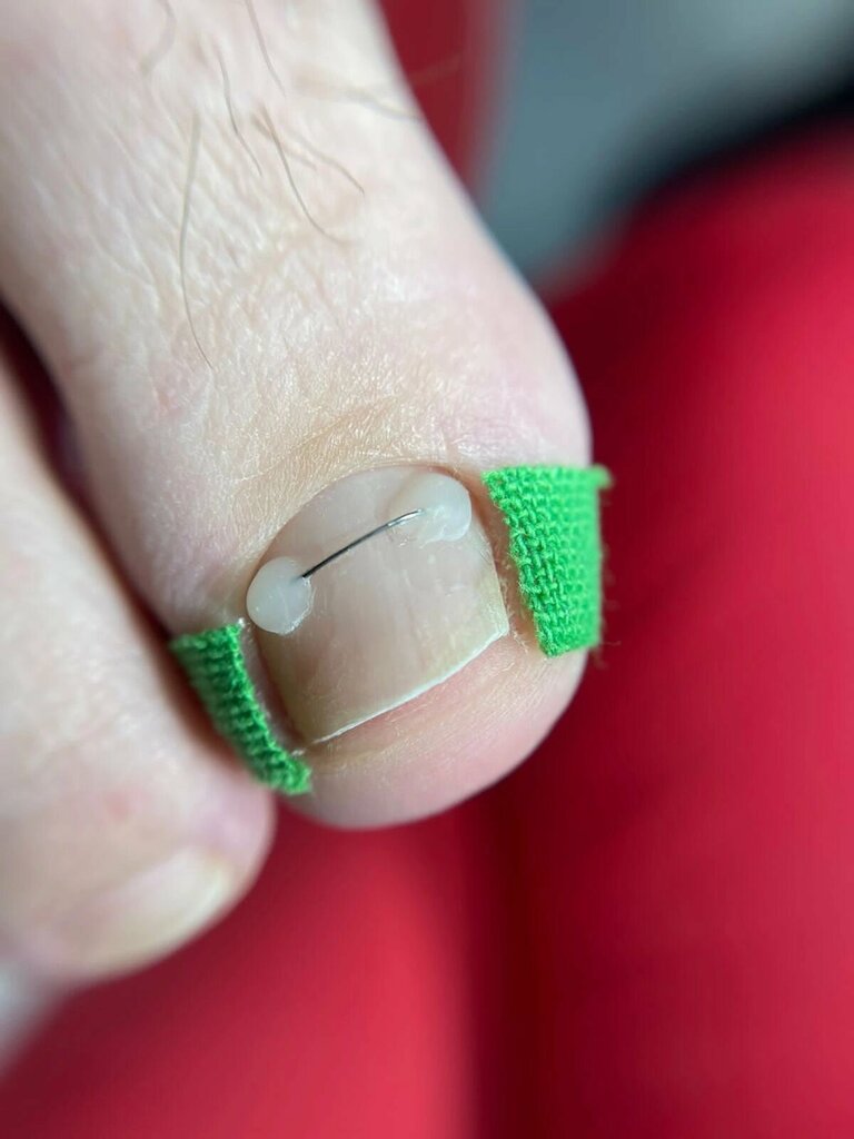 Podology ПодоБьюти, Voronezh, photo