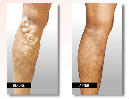 Polyclinic for adults USA Vein Clinics, Chicago, photo