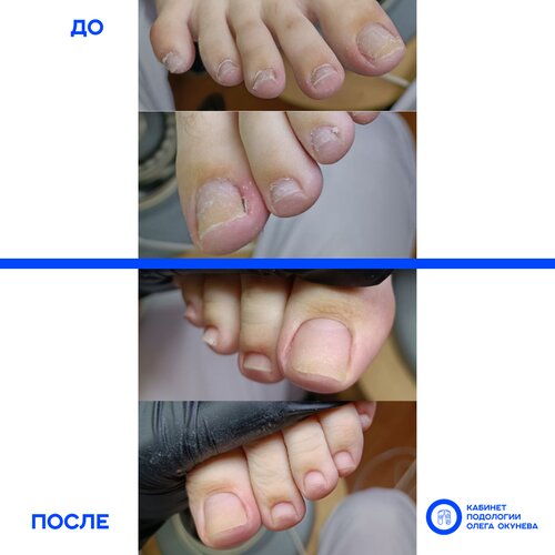 Podoloji Кабинет Подологии Олега Окунева, İvanovo, foto