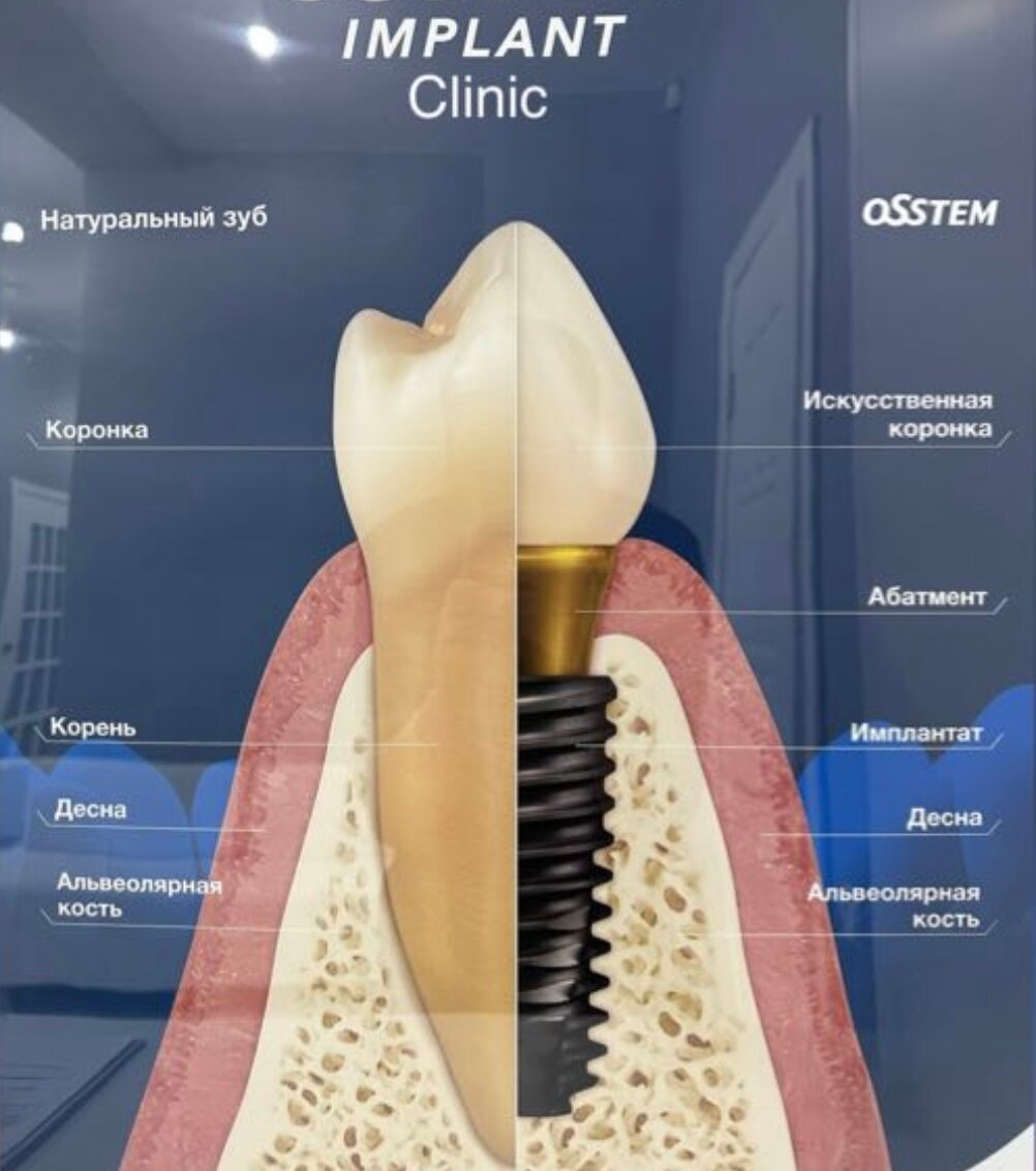Implant clinic