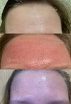 BeautySkin (Korolyova Avenue, 6Г), cosmetology